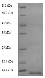 Myelin proteolipid protein (plp), partial, Oncorhynchus mykiss, recombinant