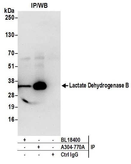 Anti-Lactate Dehydrogenase B/LDHB