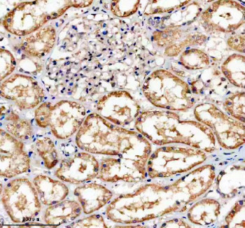Anti-TNFRSF10D / TRAIL-R4 / Tumor necrosis factor receptor superfamily member 10D