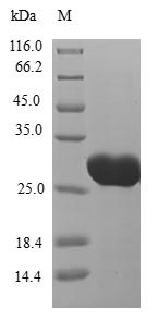 Kita-kyushu lung cancer antigen 1 (CT83), human, recombinant
