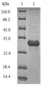 Outer membrane protein assembly factor BamA (bamA), partial, Klebsiella pneumoniae, recombinant
