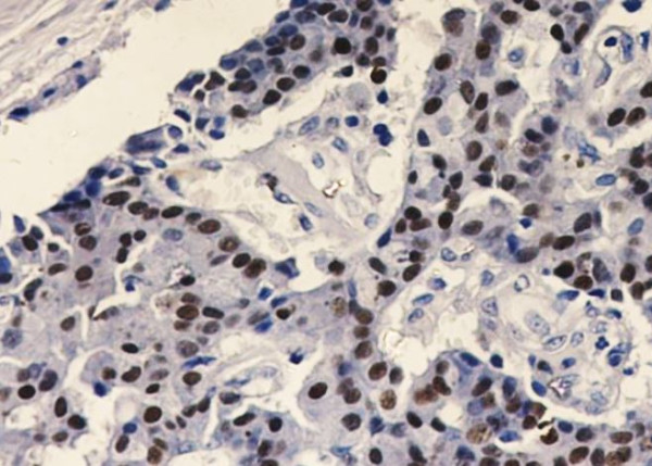 Anti-Estrogen Receptor alpha