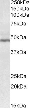 Anti-CD28