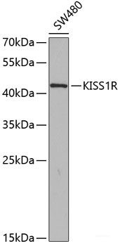 Anti-KISS1R