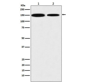 Anti-KDM4A / JMJD2A, clone AEHB-11