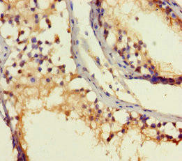 Anti-ROPN1B