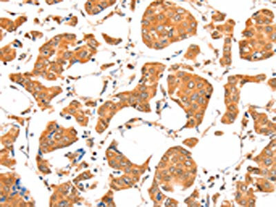 Anti-ACSM5