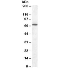 Anti-Cannabinoid Receptor