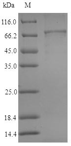 Aldehyde dehydrogenase family 1 member A3 (ALDH1A3), human, recombinant
