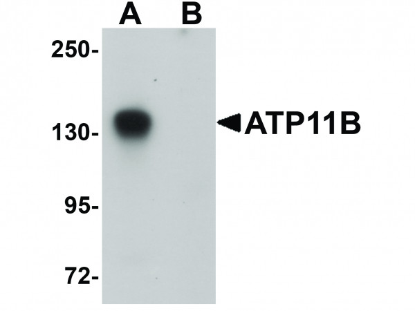 Anti-ATP11B