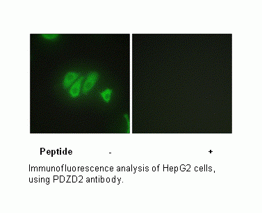 Anti-PDZD2