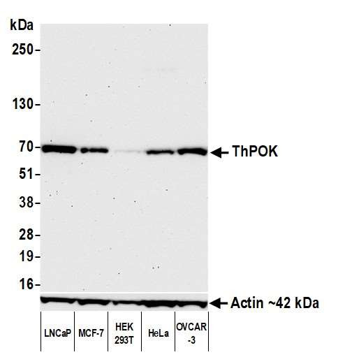 Anti-ThPOK Recombinant Monoclonal
