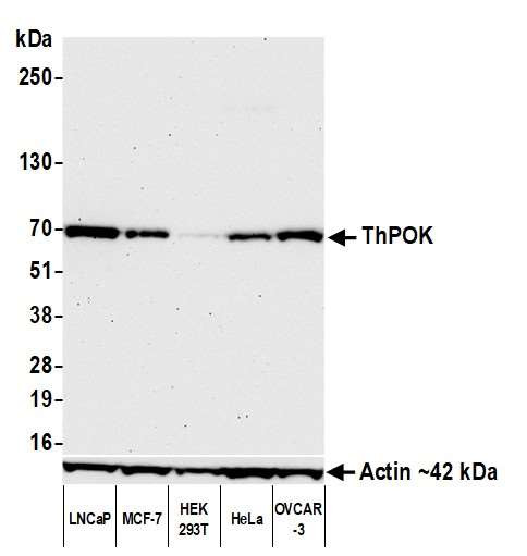 Anti-ThPOK Recombinant Monoclonal