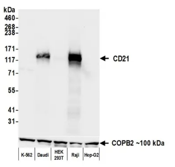 Anti-CD21 Recombinant Monoclonal