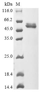 Prolactin (PRL), human, recombinant