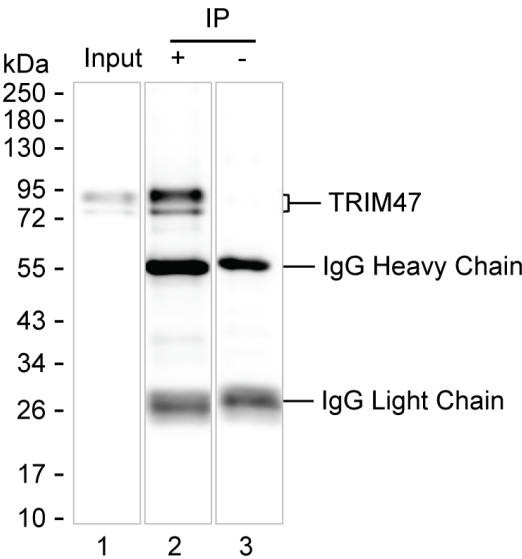 Anti-TRIM47 Magnetic Beads