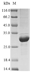 Beta-casein (CSN2), bovine, recombinant