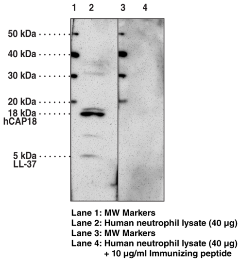 Anti-LL-37