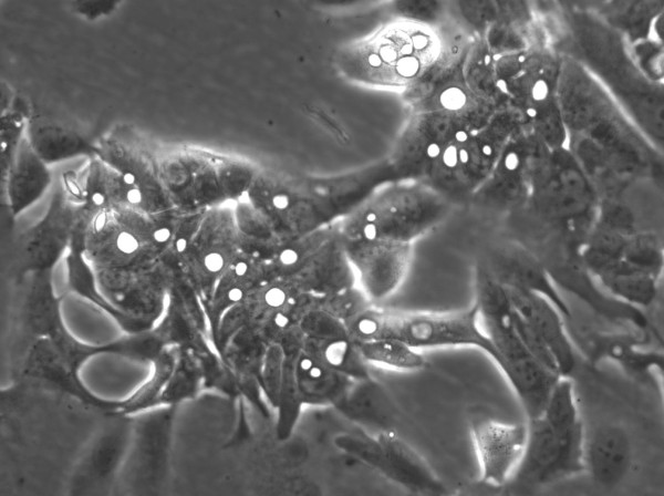 HROC383 Cells