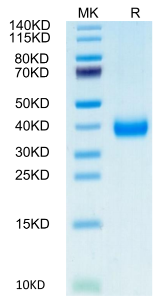 Biotinylated Cynomolgus CD161 Protein