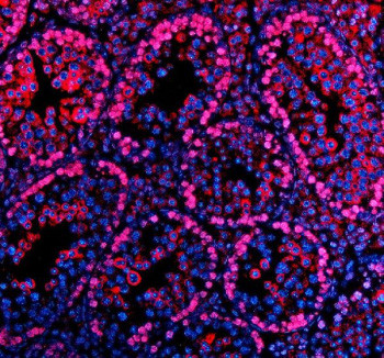 Anti-PARP11 / Poly ADP-ribose polymerase 11