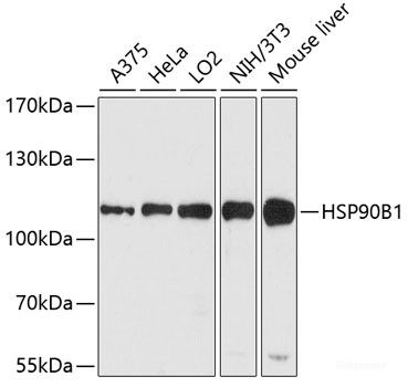 Anti-HSP90B1