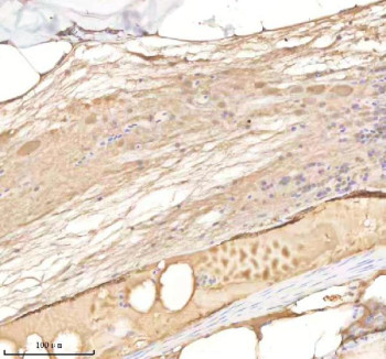 Anti-Zebrafish Rab14 / Rab14l