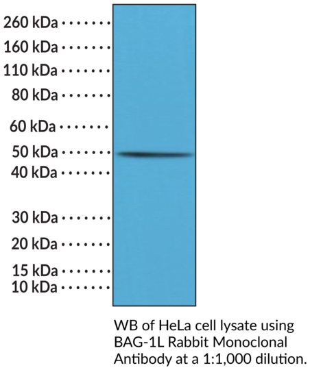Anti-BAG-1L Rabbit Monoclonal Antibody (Clone RM310)