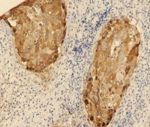 Anti-GCDFP15, clone SQab20196