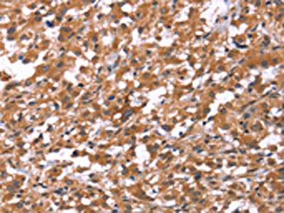 Anti-HSD17B1