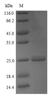 Apolipoprotein M (Apom), mouse, recombinant