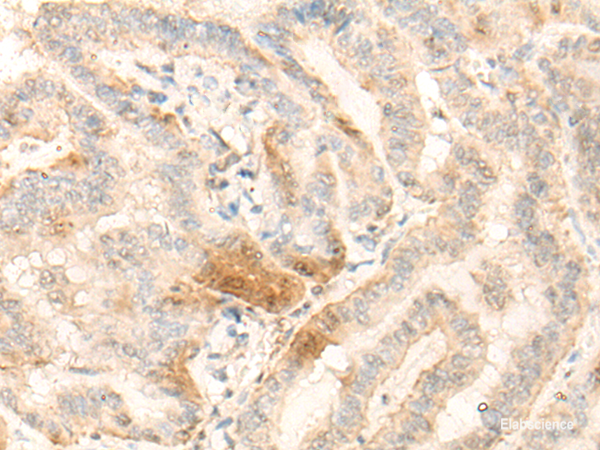 Anti-BZW2