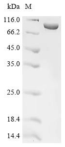 Penicillin-binding protein 1B, partial, recombinant Klebsiella pneumoniae subsp. pneumoniae