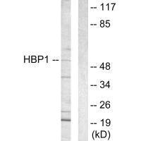 Anti-HBP1