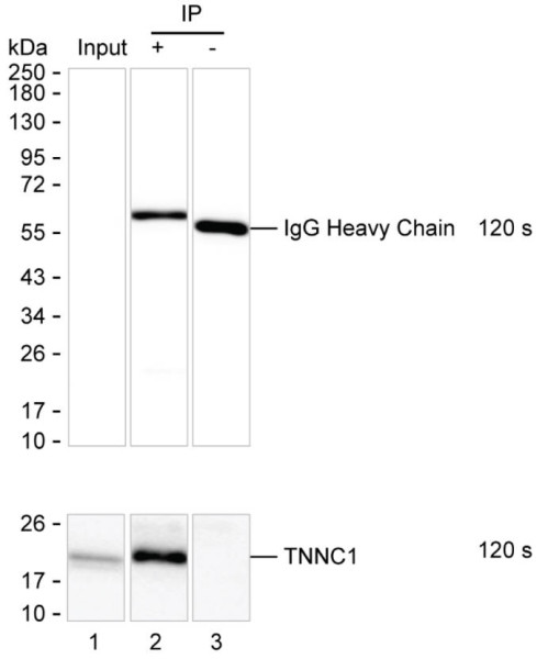 Anti-Cardiac Troponin C