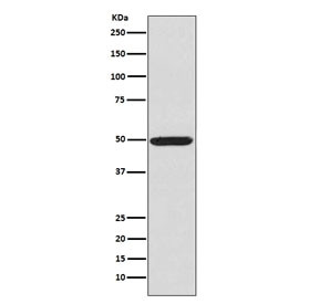 Anti-phospho-PKA R2 / PRKAR2A (Ser99), clone AOG-16