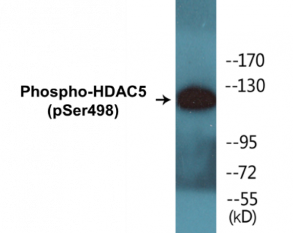 HDAC5 (Phospho-Ser498) Colorimetric Cell-Based ELISA Kit