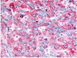 Anti-EGF-Receptor (Epidermal Growth Factor Receptor), human