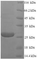 Retinoschisin (RS1), human, recombinant
