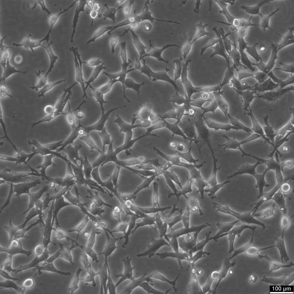 ES-2 Cells