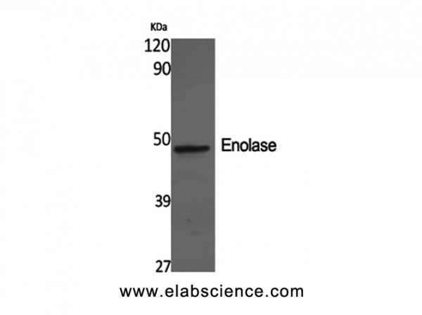 Anti-Enolase