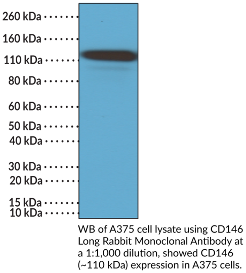 Anti-CD146 Long Rabbit Monoclonal Antibody (Clone RM249)
