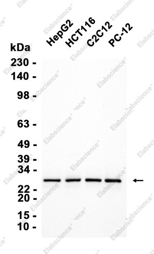 Anti-Recombinant RPS8, clone C173096