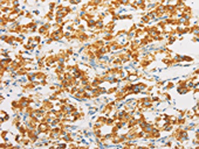 Anti-IDH3G