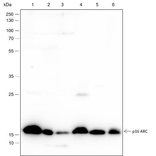 Anti-Recombinant ARPC5/p16 ARC, clone A319