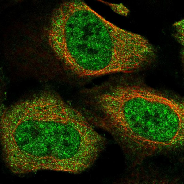 Anti-CACTIN