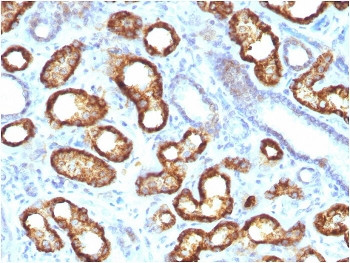 Anti-AMACR / p504S (Prostate Cancer Marker), clone AMACR/3931R