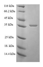 Proactivator polypeptide (PSAP), partial, human, recombinant