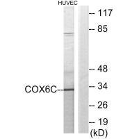 Anti-COX6C