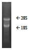 Tissue, Total RNA, Human Adult Normal, Brain, Olfactory (region)